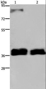 FETUB / Fetuin B Antibody - Western blot analysis of 231 and A172 cell, using FETUB Polyclonal Antibody at dilution of 1:700.