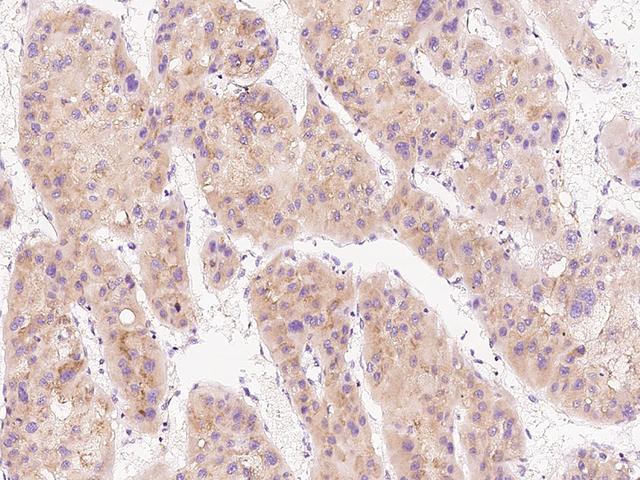 FETUB / Fetuin B Antibody - Anti-FETUB rabbit polyclonal antibody at 1:500 dilution. Lane A: 293T Whole Cell Lysate. Lysates/proteins at 30 ug per lane. Secondary: Goat Anti-Rabbit IgG (H+L)/HRP at 1/10000 dilution. Developed using the ECL technique. Performed under reducing conditions. Predicted band size: 42 kDa. Observed band size: 55 kDa.