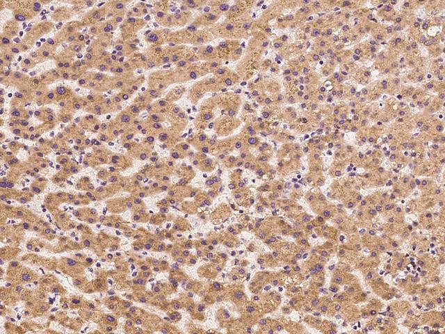 FETUB / Fetuin B Antibody - Immunochemical staining of human FETUB in human liver with rabbit polyclonal antibody at 1:300 dilution, formalin-fixed paraffin embedded sections.