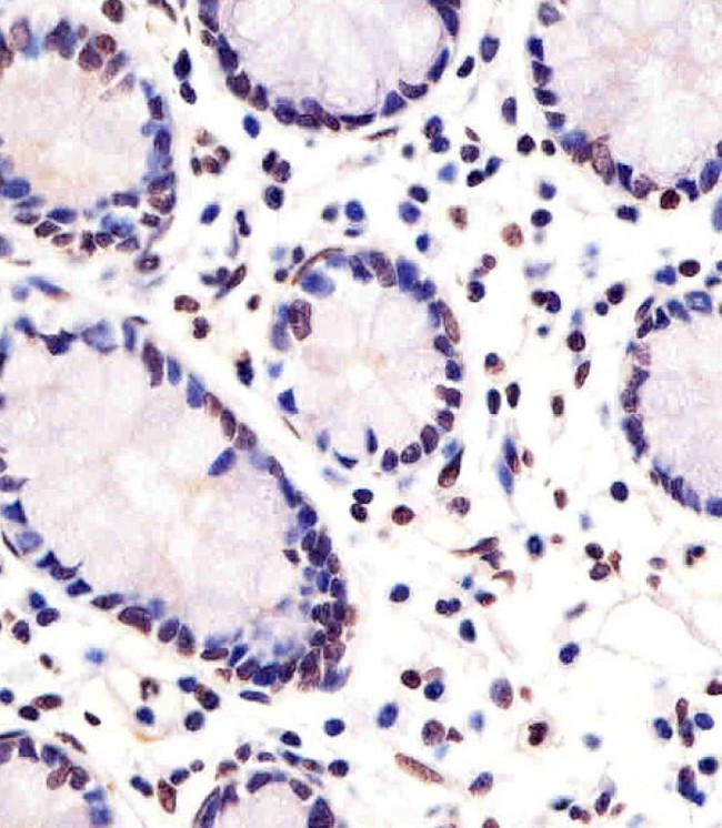 FEV / PET1 Antibody - Antibody staining FEV in human small intestine sections by Immunohistochemistry (IHC-P - paraformaldehyde-fixed, paraffin-embedded sections). Tissue was fixed with formaldehyde and blocked with 3% BSA for 0. 5 hour at room temperature; antigen retrieval was by heat mediation with a citrate buffer (pH 6). Samples were incubated with primary antibody (1:25) for 1 hours at 37°C. A undiluted biotinylated goat polyvalent antibody was used as the secondary antibody.