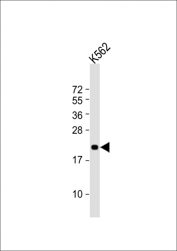 FEV / PET1 Antibody - Anti-FEV Antibody (N-Term) at 1:2000 dilution + K562 whole cell lysate Lysates/proteins at 20 ug per lane. Secondary Goat Anti-Rabbit IgG, (H+L), Peroxidase conjugated at 1:10000 dilution. Predicted band size: 25 kDa. Blocking/Dilution buffer: 5% NFDM/TBST.