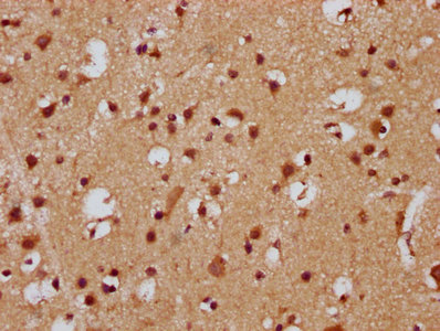 FEV / PET1 Antibody - Immunohistochemistry Dilution at 1:300 and staining in paraffin-embedded human brain tissue performed on a Leica BondTM system. After dewaxing and hydration, antigen retrieval was mediated by high pressure in a citrate buffer (pH 6.0). Section was blocked with 10% normal Goat serum 30min at RT. Then primary antibody (1% BSA) was incubated at 4°C overnight. The primary is detected by a biotinylated Secondary antibody and visualized using an HRP conjugated SP system.