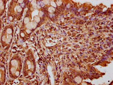 FEV / PET1 Antibody - Immunohistochemistry Dilution at 1:300 and staining in paraffin-embedded human small intestine tissue performed on a Leica BondTM system. After dewaxing and hydration, antigen retrieval was mediated by high pressure in a citrate buffer (pH 6.0). Section was blocked with 10% normal Goat serum 30min at RT. Then primary antibody (1% BSA) was incubated at 4°C overnight. The primary is detected by a biotinylated Secondary antibody and visualized using an HRP conjugated SP system.