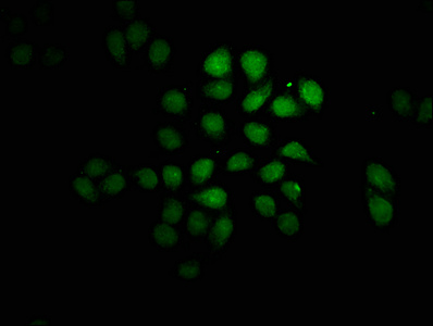 FEV / PET1 Antibody - Immunofluorescence staining of Hela cells with FEV Antibody at 1:100, counter-stained with DAPI. The cells were fixed in 4% formaldehyde, permeabilized using 0.2% Triton X-100 and blocked in 10% normal Goat Serum. The cells were then incubated with the antibody overnight at 4°C. The secondary antibody was Alexa Fluor 488-congugated AffiniPure Goat Anti-Rabbit IgG(H+L).