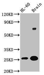 FEV / PET1 Antibody - Western Blot Positive WB detected in: HL60 whole cell lysate, Rat brain tissue All lanes: FEV antibody at 5.9µg/ml Secondary Goat polyclonal to rabbit IgG at 1/50000 dilution Predicted band size: 26 kDa Observed band size: 26 kDa