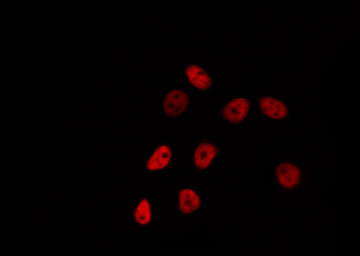 FEV / PET1 Antibody - Staining HepG2 cells by IF/ICC. The samples were fixed with PFA and permeabilized in 0.1% Triton X-100, then blocked in 10% serum for 45 min at 25°C. The primary antibody was diluted at 1:200 and incubated with the sample for 1 hour at 37°C. An Alexa Fluor 594 conjugated goat anti-rabbit IgG (H+L) Ab, diluted at 1/600, was used as the secondary antibody.