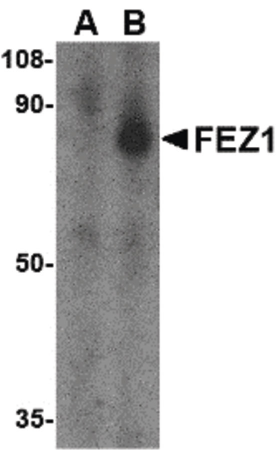 FEZ1 Antibody - Western blot of FEZ1 in SK-N-SH cell lysate with FEZ1 antibody at 1 ug/ml in the (A) presence and (B) absence of blocking peptide.