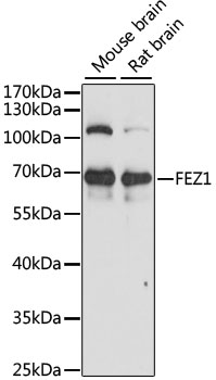 FEZ1 Antibody - Western blot analysis of extracts of various cell lines, using FEZ1 antibody at 1:1000 dilution. The secondary antibody used was an HRP Goat Anti-Rabbit IgG (H+L) at 1:10000 dilution. Lysates were loaded 25ug per lane and 3% nonfat dry milk in TBST was used for blocking. An ECL Kit was used for detection and the exposure time was 10s.