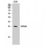 FFAR1 / GPR40 Antibody - Western blot of GPR40 antibody