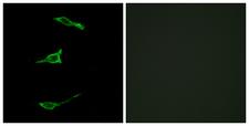 FFAR1 / GPR40 Antibody - Immunofluorescence analysis of LOVO cells, using FFAR1 Antibody. The picture on the right is blocked with the synthesized peptide.