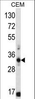 FFAR1 / GPR40 Antibody - FFAR1 Antibody western blot of CEM cell line lysates (35 ug/lane). The FFAR1 antibody detected the FFAR1 protein (arrow).