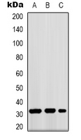 FFAR1 / GPR40 Antibody - Western blot analysis of GPR40 expression in K562 (A); mouse kidney (B); COS7 (C) whole cell lysates.