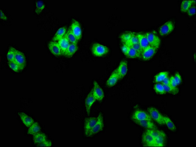 FFAR1 / GPR40 Antibody - Immunofluorescence staining of HepG2 cells at a dilution of 1:133, counter-stained with DAPI. The cells were fixed in 4% formaldehyde, permeabilized using 0.2% Triton X-100 and blocked in 10% normal Goat Serum. The cells were then incubated with the antibody overnight at 4 °C.The secondary antibody was Alexa Fluor 488-congugated AffiniPure Goat Anti-Rabbit IgG (H+L) .