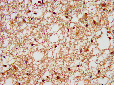 FFAR1 / GPR40 Antibody - Immunohistochemistry image at a dilution of 1:400 and staining in paraffin-embedded human brain tissue performed on a Leica BondTM system. After dewaxing and hydration, antigen retrieval was mediated by high pressure in a citrate buffer (pH 6.0) . Section was blocked with 10% normal goat serum 30min at RT. Then primary antibody (1% BSA) was incubated at 4 °C overnight. The primary is detected by a biotinylated secondary antibody and visualized using an HRP conjugated SP system.