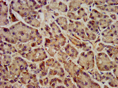 FFAR1 / GPR40 Antibody - Immunohistochemistry image at a dilution of 1:400 and staining in paraffin-embedded human pancreatic tissue performed on a Leica BondTM system. After dewaxing and hydration, antigen retrieval was mediated by high pressure in a citrate buffer (pH 6.0) . Section was blocked with 10% normal goat serum 30min at RT. Then primary antibody (1% BSA) was incubated at 4 °C overnight. The primary is detected by a biotinylated secondary antibody and visualized using an HRP conjugated SP system.
