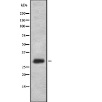 FFAR1 / GPR40 Antibody - Western blot analysis FFAR1 using K562 whole cells lysates