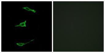 FFAR1 / GPR40 Antibody - Peptide - + Immunofluorescence analysis of LOVO cells, using FFAR1antibody.