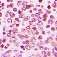 FFAR2 / GPR43 Antibody - Immunohistochemical analysis of GPR43 staining in human tonsil formalin fixed paraffin embedded tissue section. The section was pre-treated using heat mediated antigen retrieval with sodium citrate buffer (pH 6.0). The section was then incubated with the antibody at room temperature and detected using an HRP conjugated compact polymer system. DAB was used as the chromogen. The section was then counterstained with hematoxylin and mounted with DPX.