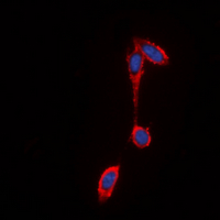 FFAR2 / GPR43 Antibody - Immunofluorescent analysis of GPR43 staining in THP1 cells. Formalin-fixed cells were permeabilized with 0.1% Triton X-100 in TBS for 5-10 minutes and blocked with 3% BSA-PBS for 30 minutes at room temperature. Cells were probed with the primary antibody in 3% BSA-PBS and incubated overnight at 4 ??C in a humidified chamber. Cells were washed with PBST and incubated with a DyLight 594-conjugated secondary antibody (red) in PBS at room temperature in the dark. DAPI was used to stain the cell nuclei (blue).