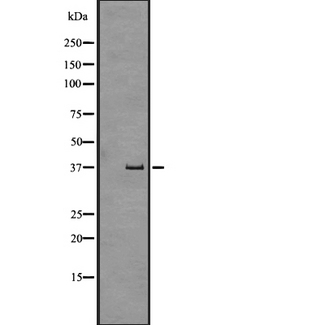 FFAR2 / GPR43 Antibody - Western blot analysis of GPR43 expression in human fetal liver tissue lysate. The lane on the left is treated with the antigen-specific peptide.