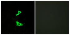 FFAR3 / GPR41 Antibody - Immunofluorescence analysis of LOVO cells, using FFAR3 Antibody. The picture on the right is blocked with the synthesized peptide.