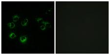 FFAR3 / GPR41 Antibody - Immunofluorescence analysis of MCF-7 cells, using GPR42 Antibody. The picture on the right is blocked with the synthesized peptide.