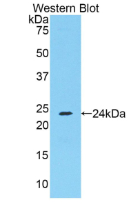 FGA / Fibrinogen Alpha Antibody - Western blot of recombinant Fibrinogen Alpha Chain / FGA.  This image was taken for the unconjugated form of this product. Other forms have not been tested.