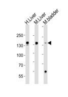 FGA / Fibrinogen Alpha Antibody - Western blot of lysates from human Liver, mouse Liver, mouse bladder tissue (from left to right), using FGA Antibody. Antibody was diluted at 1:1000 at each lane. A goat anti-mouse IgG H&L (HRP) at 1:3000 dilution was used as the secondary antibody. Lysates at 20ug per lane.