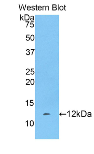 FGA / Fibrinogen Alpha Antibody - Western blot of recombinant Fibrinogen Alpha Chain / FGA.  This image was taken for the unconjugated form of this product. Other forms have not been tested.