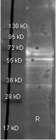 FGA / Fibrinogen Alpha Antibody - Western Blot of Goat anti-Fibrinogen antibody. Lane 1: Fibrinogen under reducing conditions. Lane 2: none. Load: 1 µg per lane. Primary antibody: Fibrinogen antibody at 1:3000 for overnight at 4°C. Secondary antibody: Dylight 488 conjugated Donkey anti goat secondary antibody at 1:10,000 for 45 min at RT. Block: TBS/MB-070 1 hr RT.