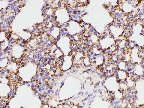 FGA / Fibrinogen Alpha Antibody - Immunohistochemistry of paraffin-embedded Rat lung using FGA Polycloanl Antibody at dilution of 1:100.