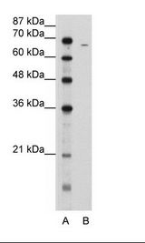 FGA / Fibrinogen Alpha Antibody - A: Marker, B: Jurkat Cell Lysate.  Antibody concentration: 5.0ug/ml.  This image was taken for the unconjugated form of this product. Other forms have not been tested.