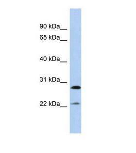 FGB / Fibrinogen Beta Chain Antibody - Western blot of Human MCF7. FGB antibody dilution 1.0 ug/ml.  This image was taken for the unconjugated form of this product. Other forms have not been tested.