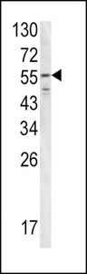 FGB / Fibrinogen Beta Chain Antibody - Western blot of FIBB antibody in T47D cell line lysates (35 ug/lane). FIBB (arrow) was detected using the purified antibody.