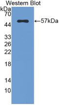 FGB / Fibrinogen Beta Chain Antibody - Western Blot;Sample: Recombinant FGb, Rat.