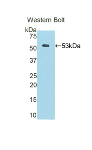 FGB / Fibrinogen Beta Chain Antibody - Western blot of recombinant FGB. This image was taken for the unconjugated form of this product. Other forms have not been tested.