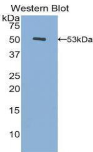 FGB / Fibrinogen Beta Chain Antibody - Western blot of recombinant FGB.  This image was taken for the unconjugated form of this product. Other forms have not been tested.