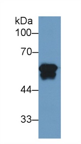 FGB / Fibrinogen Beta Chain Antibody - Western Blot; Sample: Human Liver lysate; Primary Ab: 2µg/ml Mouse Anti-Human FGb Antibody Second Ab: 0.2µg/mL HRP-Linked Caprine Anti-Mouse IgG Polyclonal Antibody