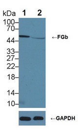 FGB / Fibrinogen Beta Chain Antibody - Knockout Varification: Lane 1: Wild-type Hela cell lysate; Lane 2: FGb knockout Hela cell lysate; Predicted MW: 56kDa ; Observed MW: 56kDa; Primary Ab: 2µg/ml Rabbit Anti-Human FGb Antibody; Second Ab: 0.2µg/mL HRP-Linked Caprine Anti-Rabbit IgG Polyclonal Antibody;