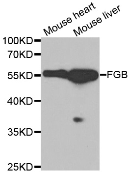 FGB / Fibrinogen Beta Chain Antibody - Western blot analysis of extracts of various cell lines, using FGB antibody at 1:1000 dilution. The secondary antibody used was an HRP Goat Anti-Rabbit IgG (H+L) at 1:10000 dilution. Lysates were loaded 25ug per lane and 3% nonfat dry milk in TBST was used for blocking.
