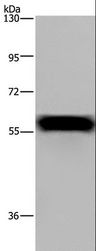 FGB / Fibrinogen Beta Chain Antibody - Western blot analysis of Mouse heart tissue, using FGB Polyclonal Antibody at dilution of 1:1000.