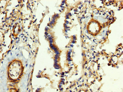 FGB / Fibrinogen Beta Chain Antibody - Immunohistochemistry image at a dilution of 1:400 and staining in paraffin-embedded human lung tissue performed on a Leica BondTM system. After dewaxing and hydration, antigen retrieval was mediated by high pressure in a citrate buffer (pH 6.0) . Section was blocked with 10% normal goat serum 30min at RT. Then primary antibody (1% BSA) was incubated at 4 °C overnight. The primary is detected by a biotinylated secondary antibody and visualized using an HRP conjugated SP system.