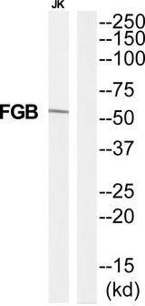 FGB / Fibrinogen Beta Chain Antibody - Western blot analysis of extracts from Jurkat cells, using FIBB antibody.