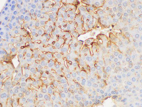 FGB / Fibrinogen Beta Chain Antibody - Immunohistochemistry of paraffin-embedded Mouse liver using FGB Polycloanl Antibody at dilution of 1:200.