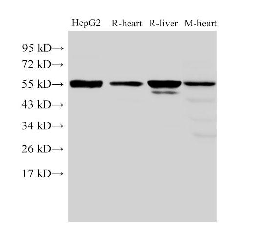 FGB / Fibrinogen Beta Chain Antibody - Western Blot analysis of HepG2 cells, Rat heart, Rat liver and Mouse heart using FGB Polyclonal Antibody at dilution of 1:4000.