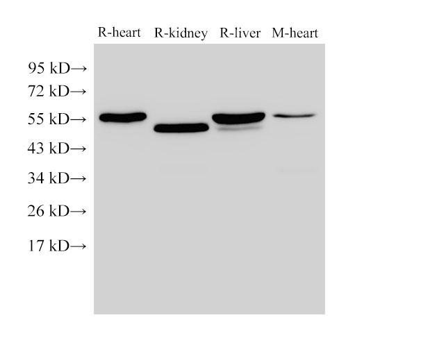 FGB / Fibrinogen Beta Chain Antibody - Western Blot analysis of Rat heart, Rat kidney, Rat liver and Mouse heart using FGB Polyclonal Antibody at dilution of 1:4000.