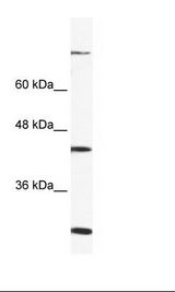 FGD1 Antibody - Raji Cell Lysate.  This image was taken for the unconjugated form of this product. Other forms have not been tested.