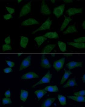 FGD1 Antibody - Immunofluorescence analysis of L929 cells using FGD1 Polyclonal Antibody at dilution of 1:100 (40x lens).Blue: DAPI for nuclear staining.