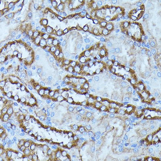 FGD1 Antibody - Immunohistochemistry of paraffin-embedded Rat kidney using FGD1 Polyclonal Antibody at dilution of 1:100 (40x lens).