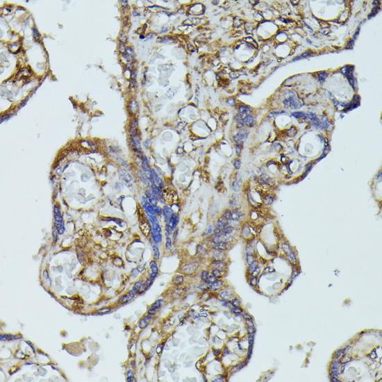 FGD1 Antibody - Immunohistochemistry of paraffin-embedded Human placenta using FGD1 Polyclonal Antibody at dilution of 1:100 (40x lens).